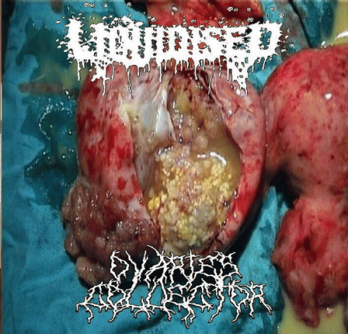 Liquidised : Liquidised - Ovaries Collector